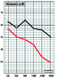 Sanayi Yapıları Tesisatlarında Gürültü Yalıtımı Sanayi Yapıları Tesisatlarında Gürültü Yalıtımı